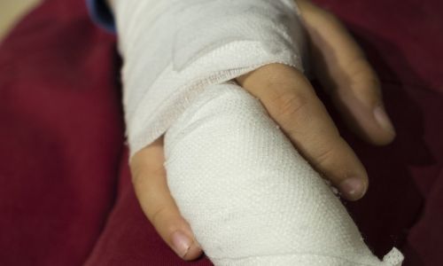 пьяный россиянин отрубил пальцы своей пятилетней племяннице