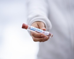 В Приамурье пятеро новых заболевших коронавирусом: всего в области 33 подтвержденных случая