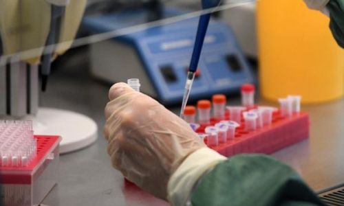 анализ на коронавирус теперь будут делать и в тынде: в городе открылась пцр-лаборатория
