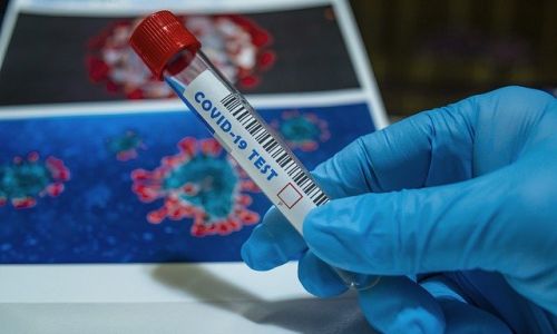 плюс восемь: три новых случая коронавируса выявлено в свободном
