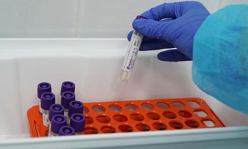 минздрав рф: лаборатории по тестированию на коронавирус должны работать круглосуточно
