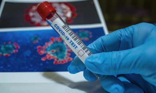 количество случаев коронавируса в приамурье перевалило за 70:  за последние сутки выявили еще 5 заболевших
