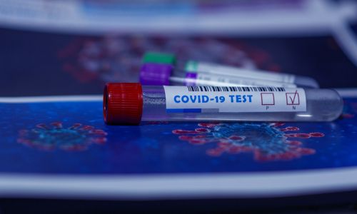 жительница свободного рассказала о проблеме с платными тестами на коронавирус
